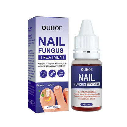 1PCS Nail Fungal Treatment Feet Care Essence Anti Infection Onychomycosis Paronychia Fungus Toe Removal Serum Fungal Nail R V5V8